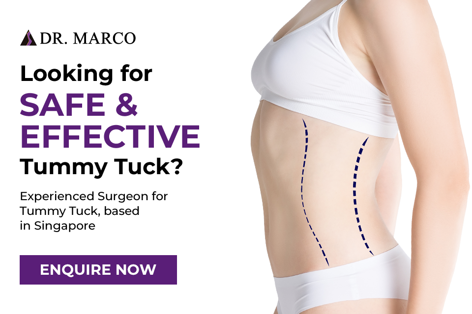 Tummy Tuck Banner